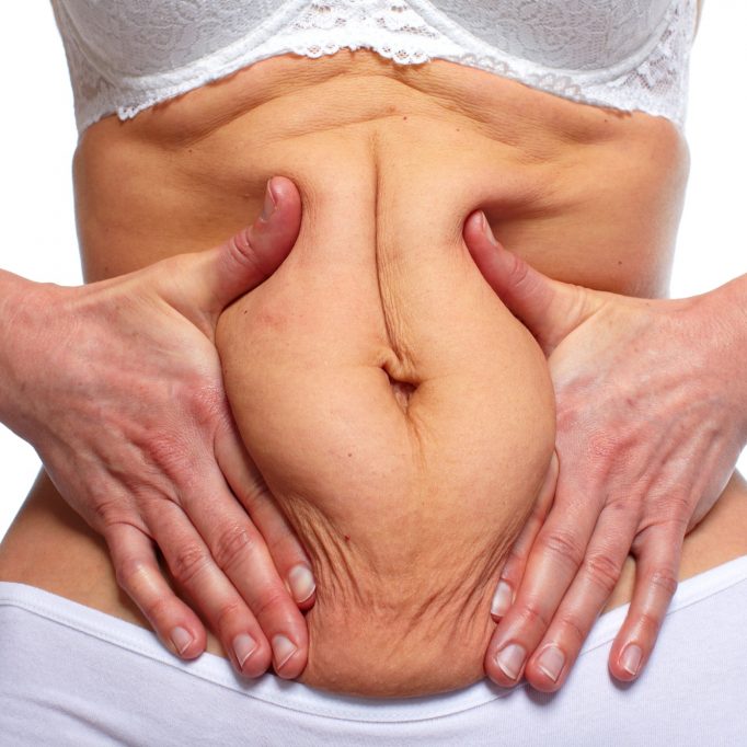 Woman fat belly. Woman fat belly. Overweight and weight loss concept.